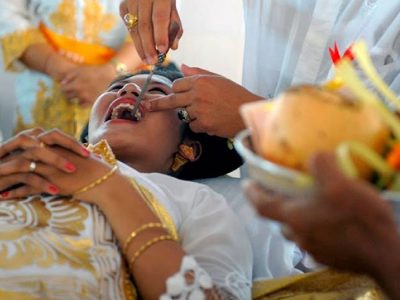 tooth filing-min Bali car rental with driver